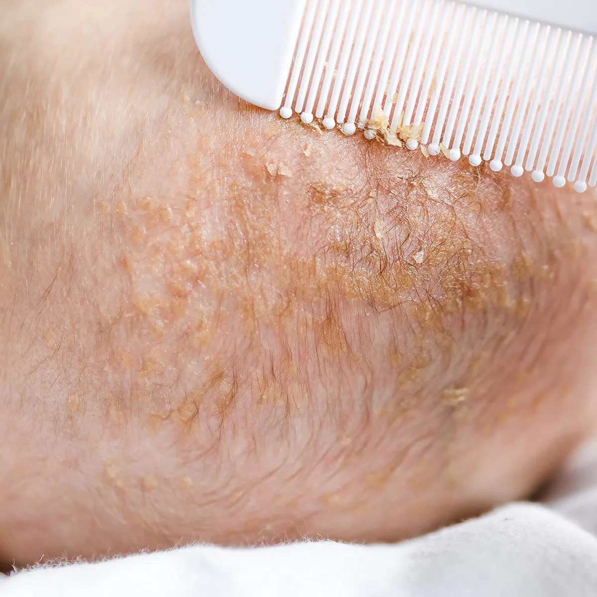 LuvLap Babykamm mit abgerundeten Spitzen & Babyhaarbürste mit Naturborsten zur besseren Prrotektion der Baby-Kopfhaut, Weiß & Blau
