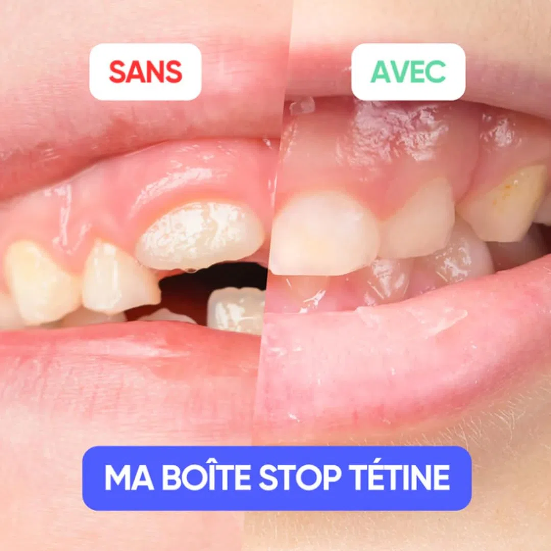MEINE BOITE STOP TETINE